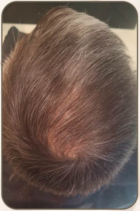 Efter – Tor